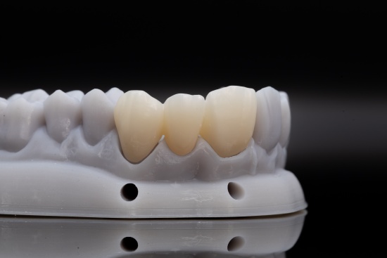 7546a23e-266b-ba90-bf55-ea2d9ffd8149_副本.jpg 7546a23e-266b-ba90-bf55-ea2d9ffd8149_副本.jpg