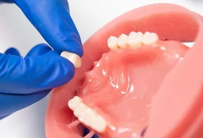 dental implant material cost