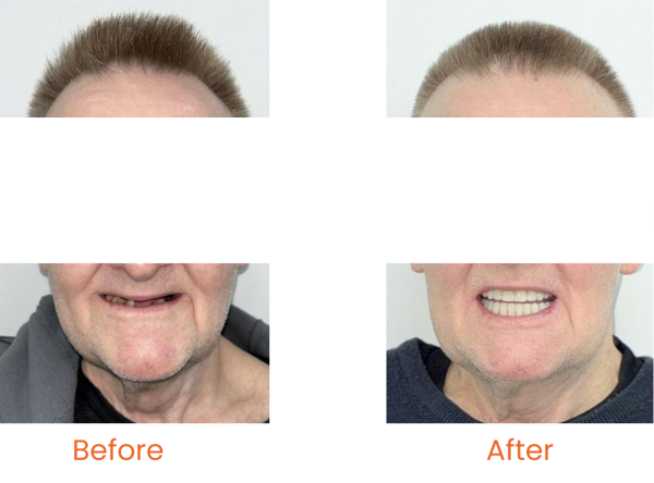 7e2fe156-9cb4-b6f2-e2f7-3d3022bb7afd_副本.png 7e2fe156-9cb4-b6f2-e2f7-3d3022bb7afd_副本.png