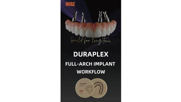 Full Arch Implant Workflow with DuraPlex PMMA & Gumimic